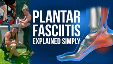 Plantar Fasciitis Explained Simply